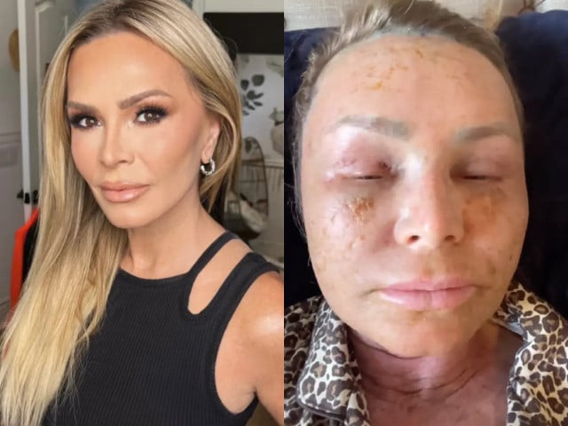 courtesy tamra judge instagram courtesy tamra judge instagram