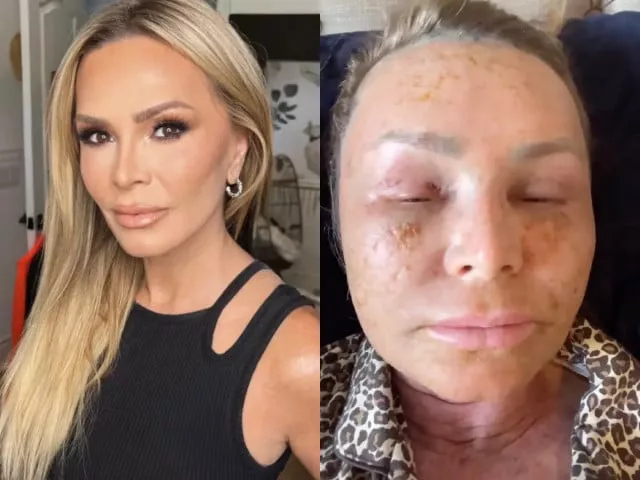courtesy tamra judge instagram courtesy tamra judge instagram