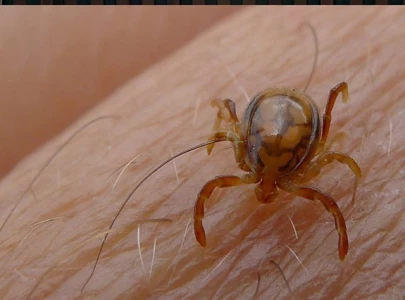 two congo virus patients hospitalised in peshawar two congo virus patients hospitalised in peshawar