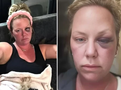 canadian woman assaulted at hotel in cuba raising safety fears for tourists canadian woman assaulted at hotel in cuba raising safety fears for tourists