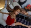 57 children in gaza died from malnutrition since march who 57 children in gaza died from malnutrition since march who