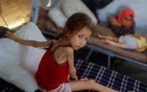 57 children in gaza died from malnutrition since march who 57 children in gaza died from malnutrition since march who