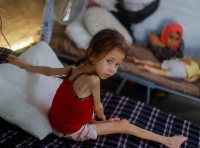 57 children in gaza died from malnutrition since march who 57 children in gaza died from malnutrition since march who