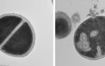 scientists discover new immune system feature with potential for antibiotics