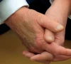white house explains trump s bruised hand amid online speculation white house explains trump s bruised hand amid online speculation
