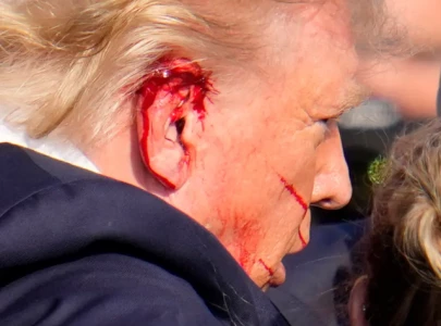 donald trump confirms that a chunk of his ear is gone