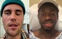 lil nas x facial paralysis draws comparisons to justin bieber s ramsay hunt syndrome diagnosis lil nas x facial paralysis draws comparisons to justin bieber s ramsay hunt syndrome diagnosis
