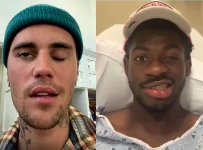 lil nas x facial paralysis draws comparisons to justin bieber s ramsay hunt syndrome diagnosis lil nas x facial paralysis draws comparisons to justin bieber s ramsay hunt syndrome diagnosis