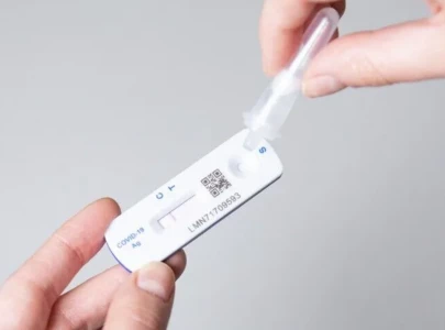 severe covid may reactivate dormant viruses study finds severe covid may reactivate dormant viruses study finds