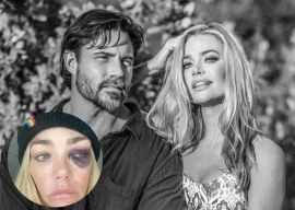 did aaron phypers abuse denise richards actress tearfully details disturbing allegations did aaron phypers abuse denise richards actress tearfully details disturbing allegations