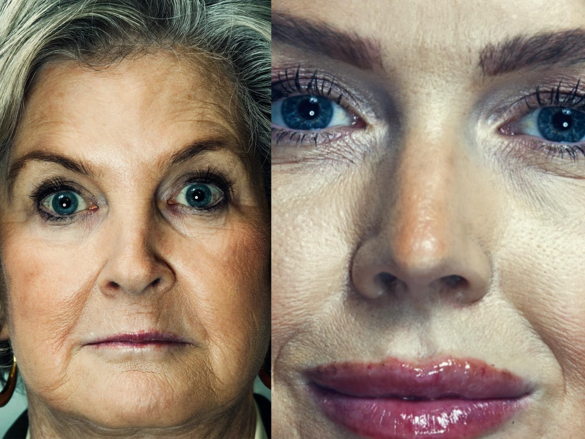 photo instagram vanityfair