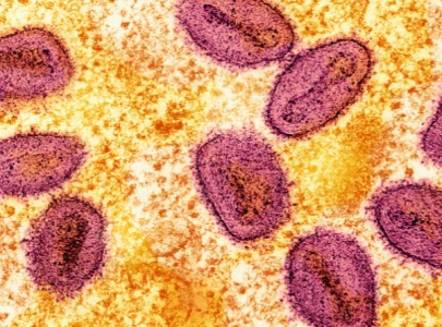 mpox spread what you need to know to protect yourself