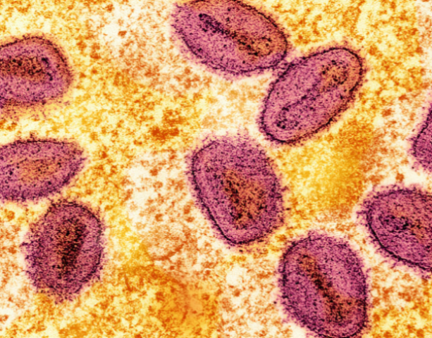 mpox spread what you need to know to protect yourself mpox spread what you need to know to protect yourself