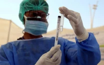 overall risk of nipah outbreak in pakistan remains low nih informs high level meeting