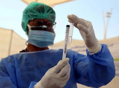 overall risk of nipah outbreak in pakistan remains low nih informs high level meeting overall risk of nipah outbreak in pakistan remains low nih informs high level meeting