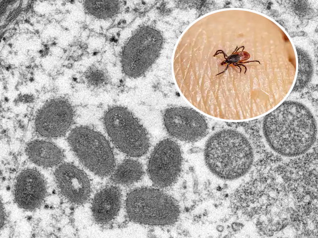 concerns grow after new tick borne virus discovered in china concerns grow after new tick borne virus discovered in china