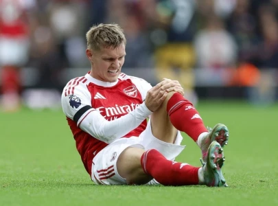 arteta not positive after odegaard sets unwanted injury record arteta not positive after odegaard sets unwanted injury record