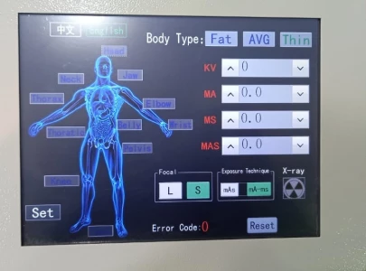 meet pakistan s homemade x ray machine meet pakistan s homemade x ray machine