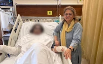 quetta acid attack victim dr mahnoor stable eyesight intact after treatment at akuh quetta acid attack victim dr mahnoor stable eyesight intact after treatment at akuh