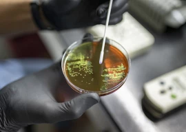 who warns against drug resistant superbugs who warns against drug resistant superbugs