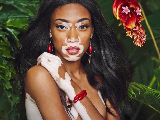 WINNIE HARLOW PHOTO:FILE