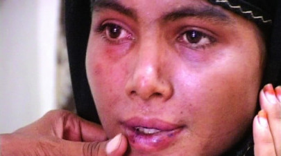 20 year old survives acid and blade attack