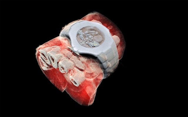 3-D, colour X-ray on a human, using a technique promising to improve the field of medical diagnostics, announced Europe's CERN physics lab. PHOTO: AFP